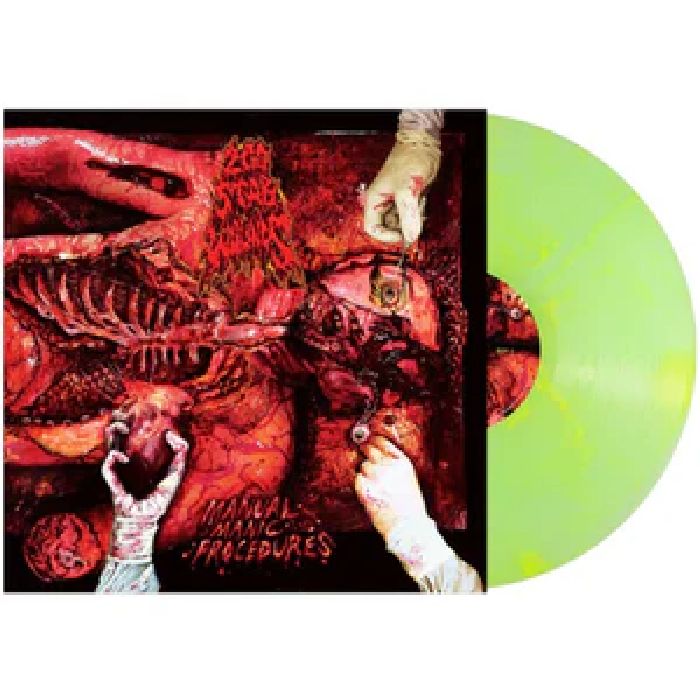 200 Stab Wounds - Manual Manic Procedures (Plutonium Green/Yellow Marble Vinyl) - Vinyl - New